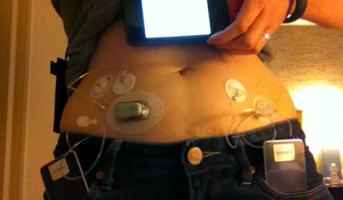 Bionic Pancreas Beacon Hill fot. healthline.com