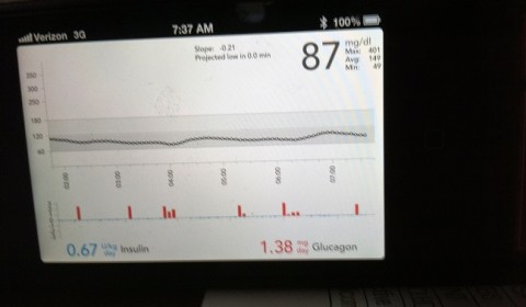 Bionic Pancreas Data Screen fot. healthline.com
